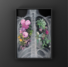 Load image into Gallery viewer, Pneumoflora Floral Chest Xray Art Print | Trisha Thompson Adams (OK)
