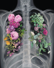 Load image into Gallery viewer, Pneumoflora Floral Chest Xray Art Print | Trisha Thompson Adams (OK)