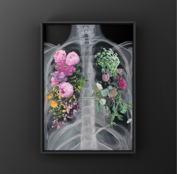 Pneumoflora Floral Chest Xray Art Print | Trisha Thompson Adams (OK)